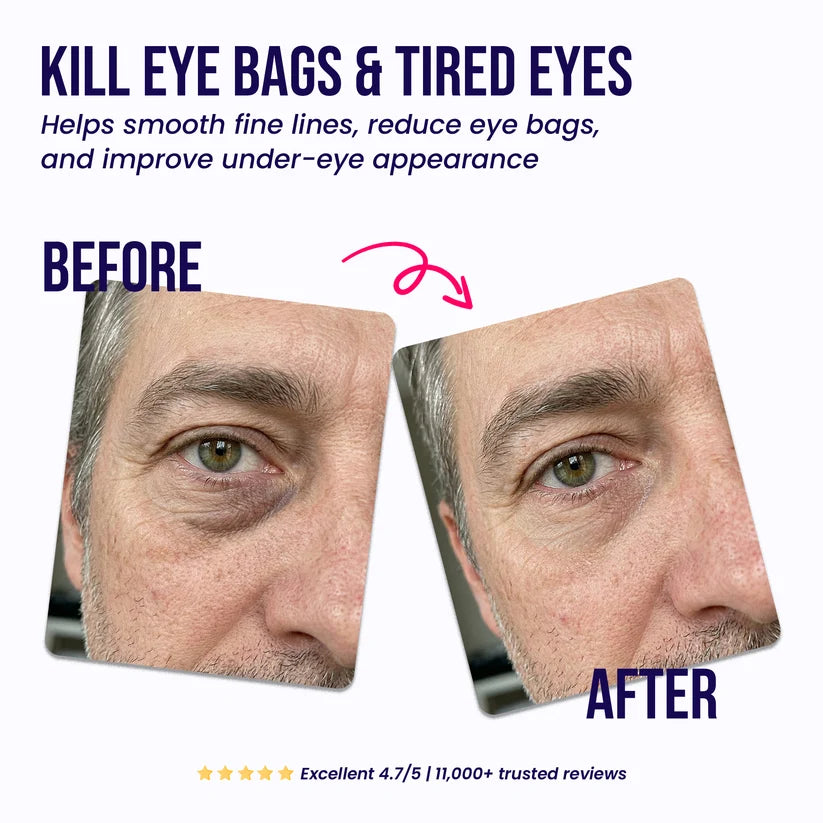 AgeBack - Under-Eye Repair Patches