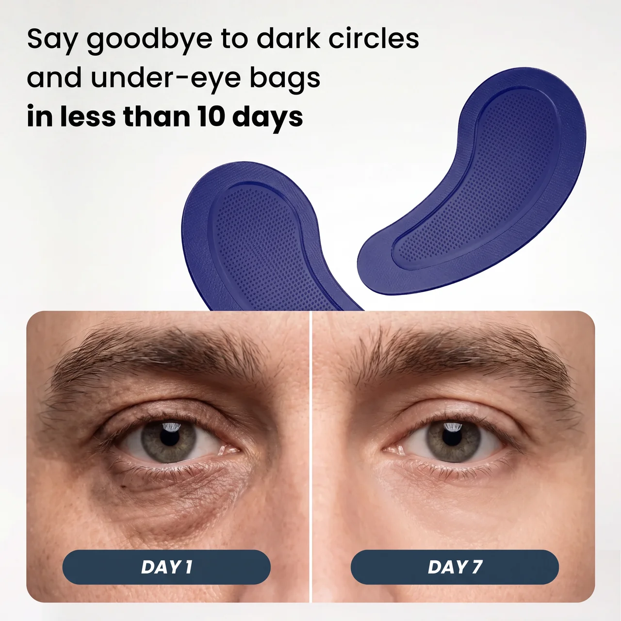 Microneedle Patches | New Generation
