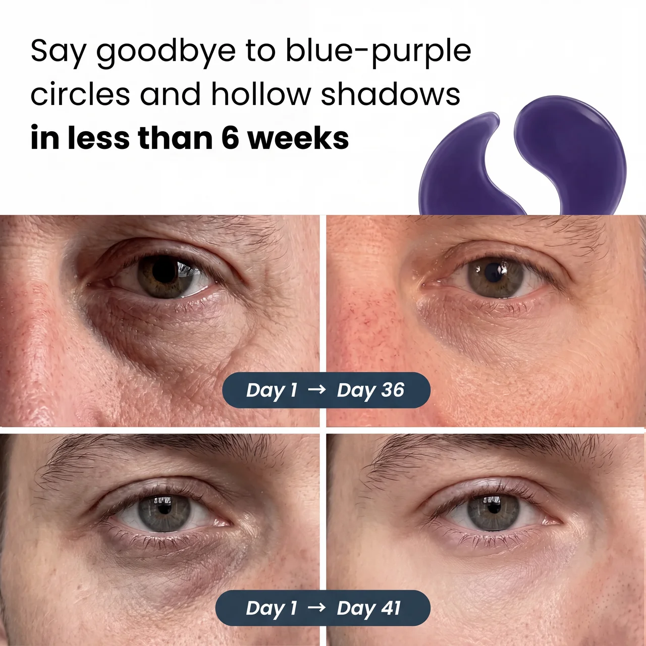 Hydrogel Eye Patches