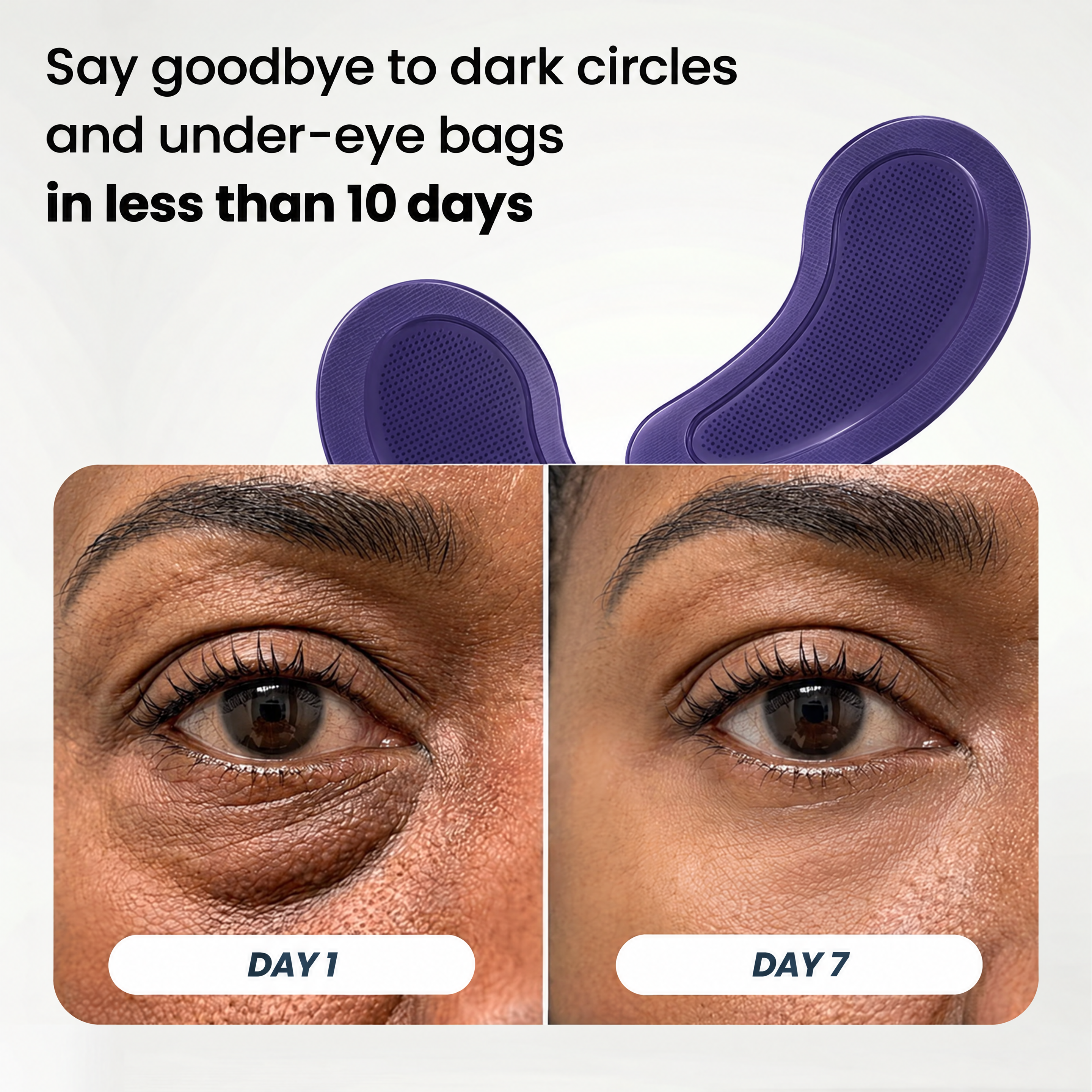 Microneedle Patches | New Generation