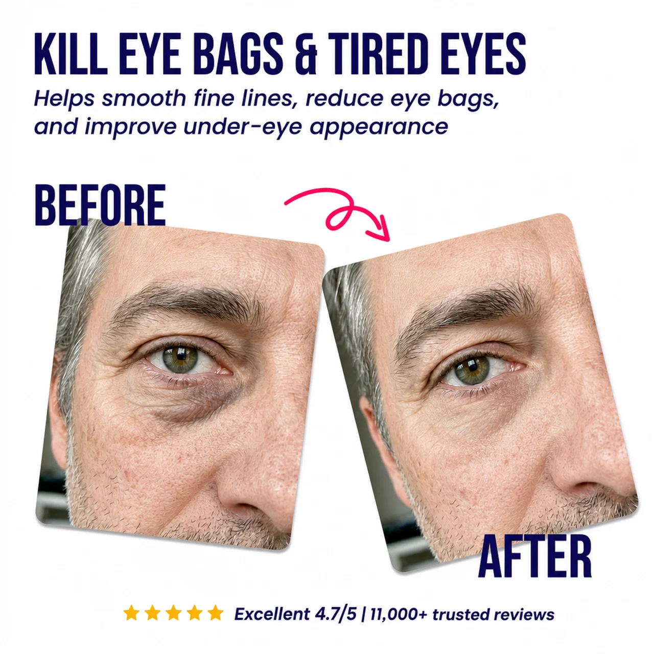 AgeBack - Under-Eye Repair Patches