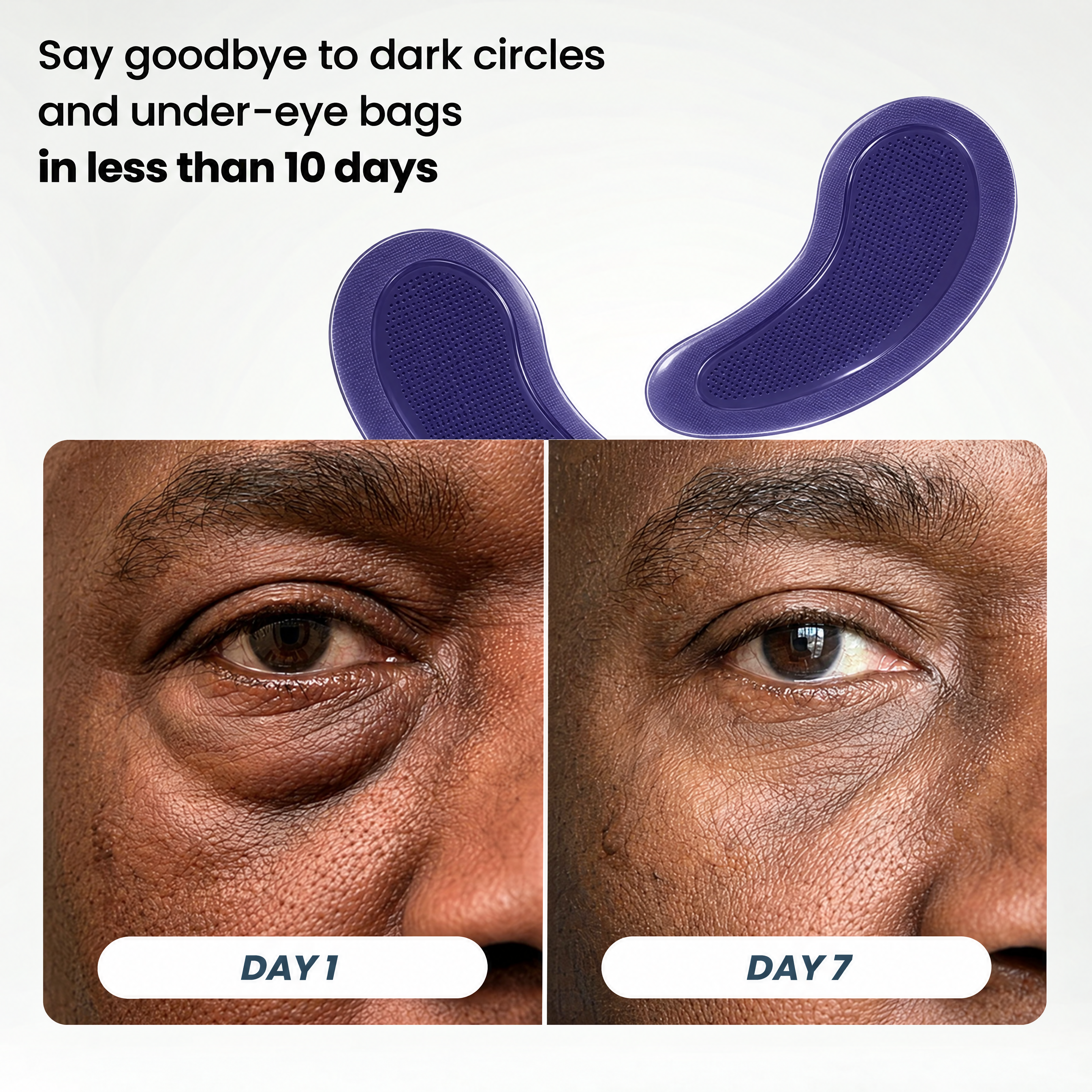 Microneedle Patches | New Generation